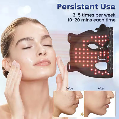8-Color Silicone LED Face Mask — Red Light Therapy & Infrared Anti-Aging Photon Mask